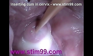 Wrapround goo cum hither cervix in the matter of dilation wet crack speculum